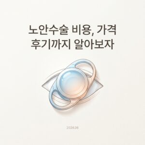 노안수술 비용, 가격 후기까지 알아보자