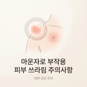 마운자로 부작용 피부 쓰라림 주의사항