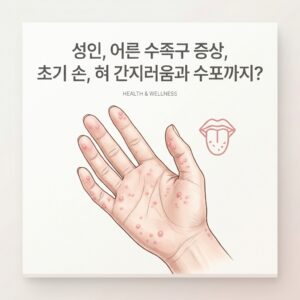 성인, 어른 수족구 증상, 초기 손, 혀 간지러움과 수포까지?