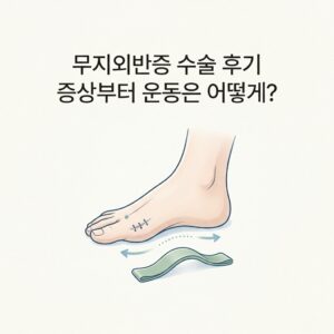 무지외반증 수술 후기 증상부터 운동은 어떻게?